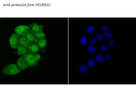 HUABIO ER1706-52 image 3