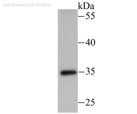 HUABIO ER1706-55 image 1