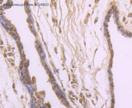 HUABIO ER1706-55 image 3