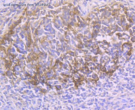 HUABIO ER1706-56 image 3