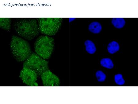 HUABIO ER1706-65 image 1