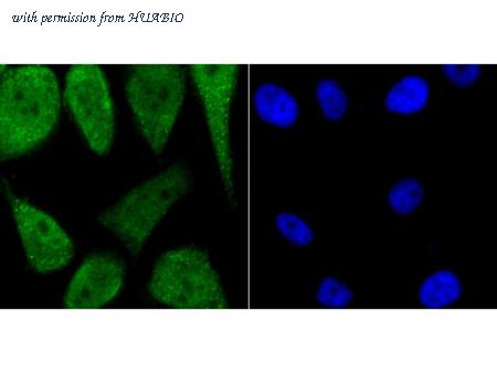 HUABIO ER1706-65 image 2