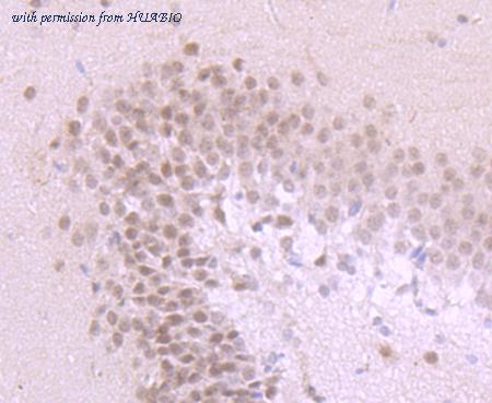 HUABIO ER1706-65 image 3