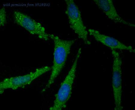 HUABIO ER1706-69 image 2