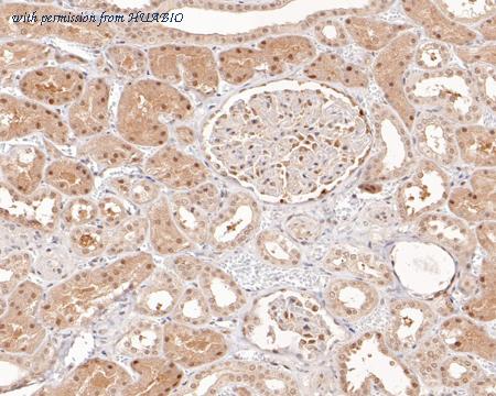 HUABIO ER1706-70 image 2