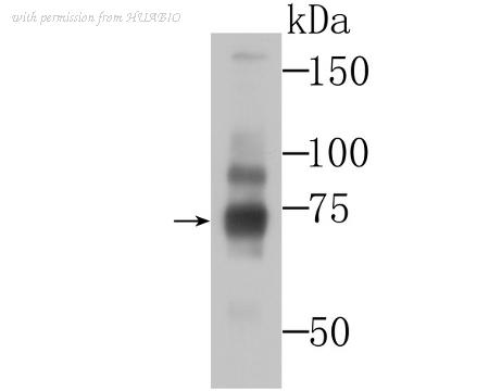 HUABIO ER1706-71 image 1