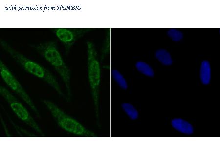 HUABIO ER1706-74 image 3