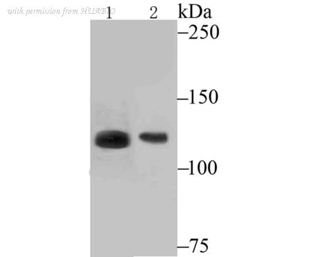 HUABIO ER1706-75 image 1