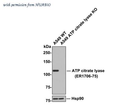 HUABIO ER1706-75 image 2