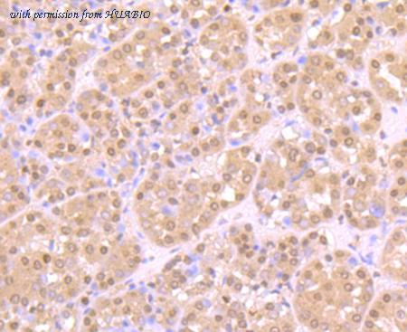 HUABIO ER1706-82 image 1