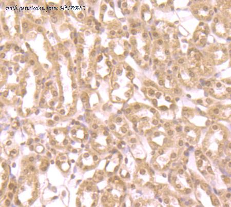 HUABIO ER1706-82 image 2