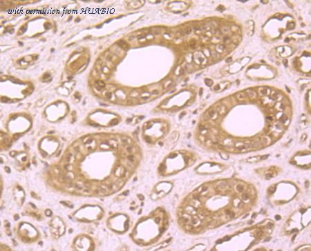 HUABIO ER1706-82 image 3