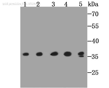 HUABIO ER1706-83 image 1