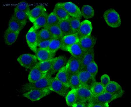 HUABIO ER1706-83 image 2