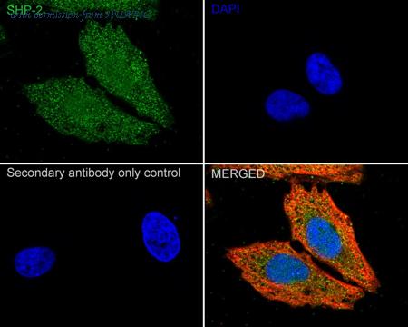 HUABIO ER1706-93 image 2