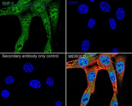 HUABIO ER1706-93 image 3