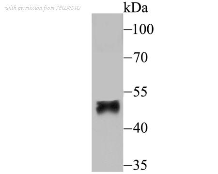 HUABIO ER1802-3 image 1