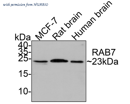 HUABIO ER1802-53 image 1