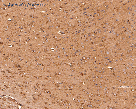 HUABIO ER1802-53 image 2