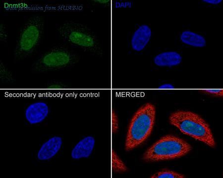 HUABIO ER1802-55 image 1