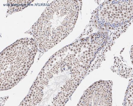 HUABIO ER1802-55 image 3