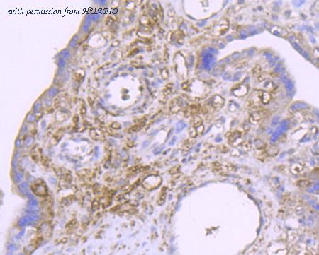 HUABIO ER1802-6 image 3