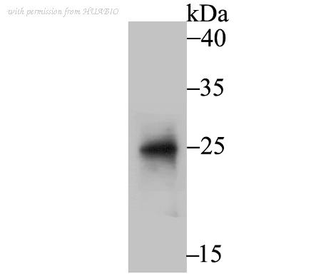 HUABIO ER1802-66 image 1
