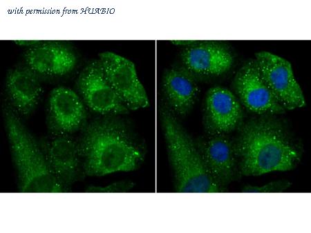 HUABIO ER1802-8 image 1