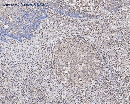 HUABIO ER1802-81 image 3