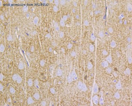 HUABIO ER1802-94 image 2