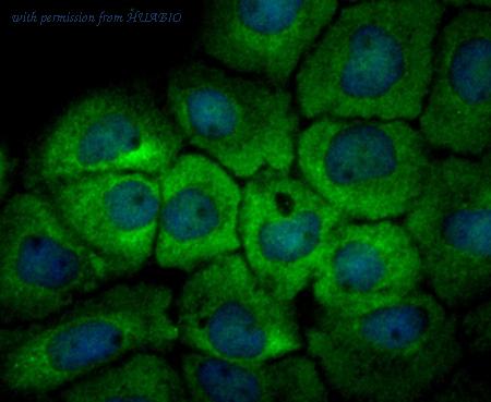 HUABIO ER1803-02 image 2