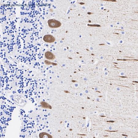 HUABIO ER1803-17 image 2