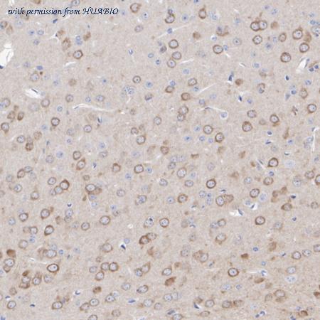 HUABIO ER1803-17 image 3