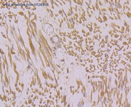 HUABIO ER1803-19 image 2