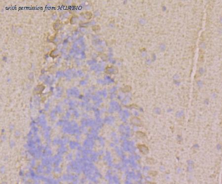 HUABIO ER1803-19 image 3