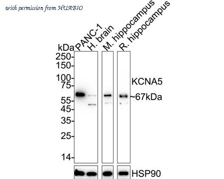 HUABIO ER1803-23 image 1