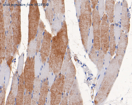 HUABIO ER1803-23 image 2