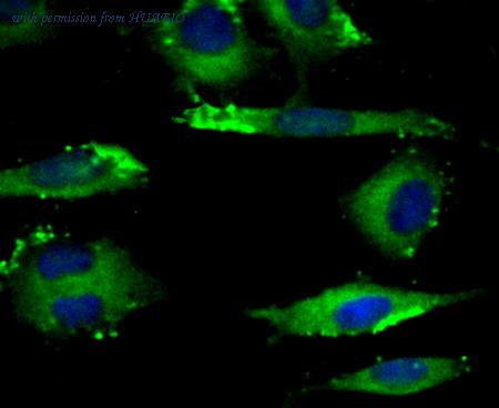 HUABIO ER1803-25 image 2