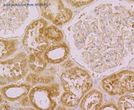 HUABIO ER1803-29 image 3