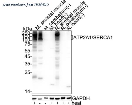 HUABIO ER1803-34 image 1