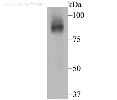 HUABIO ER1803-43 image 1