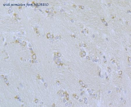 HUABIO ER1803-47 image 2