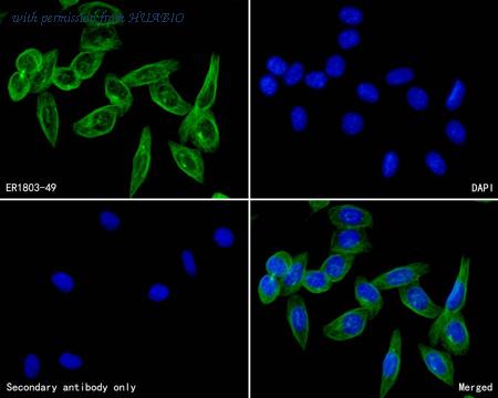 HUABIO ER1803-49 image 2