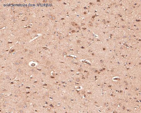 HUABIO ER1803-57 image 3