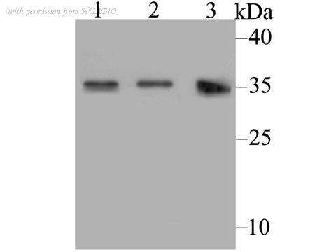 HUABIO ER1803-58 image 1