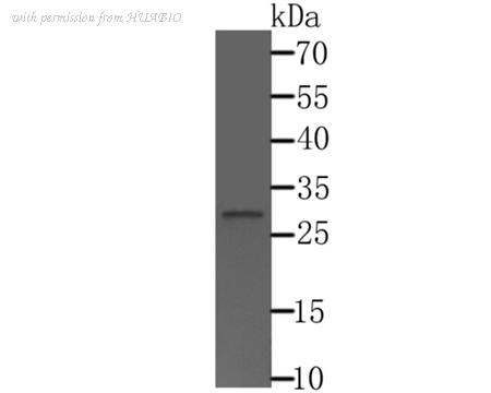 HUABIO ER1803-59 image 1