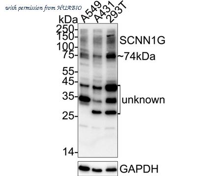 HUABIO ER1803-61 image 1