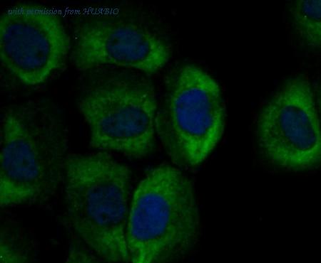 HUABIO ER1803-61 image 3