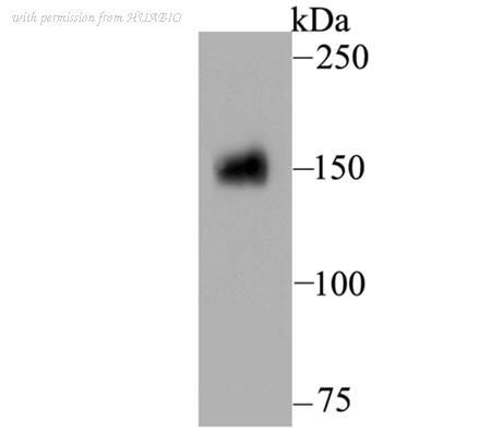 HUABIO ER1803-74 image 1