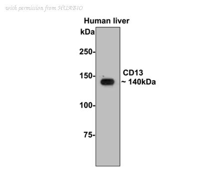 HUABIO ER1803-74 image 2